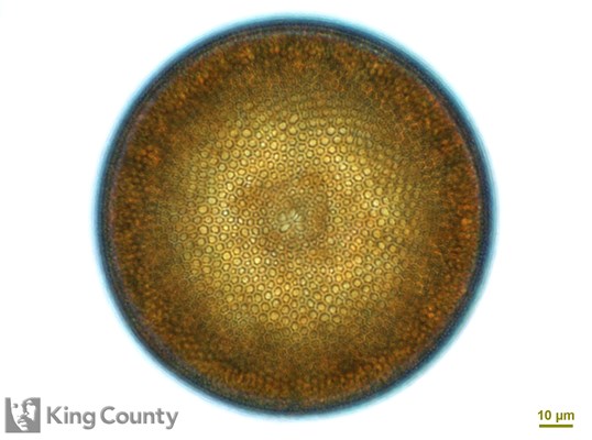 Photo of Coscinodiscus centralis